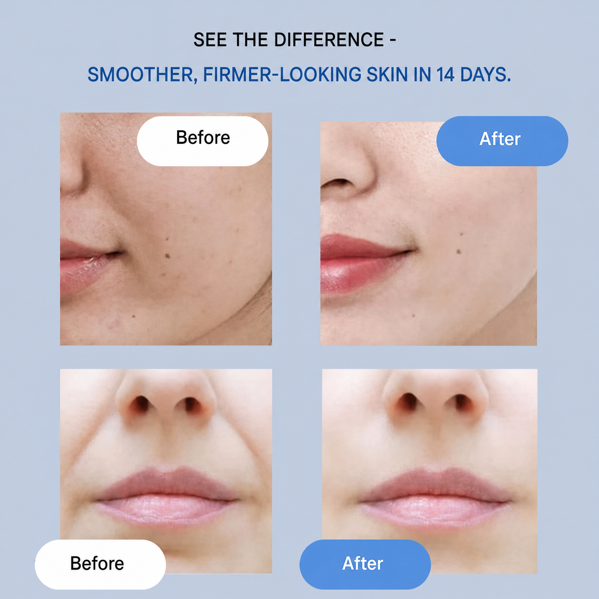 Lifting face strips | Instantly smooth & tighten | Anti-wrinkle care without surgery | YouthLift Renew